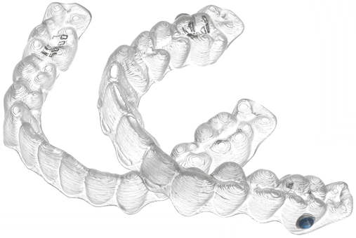 Invisalign aligners