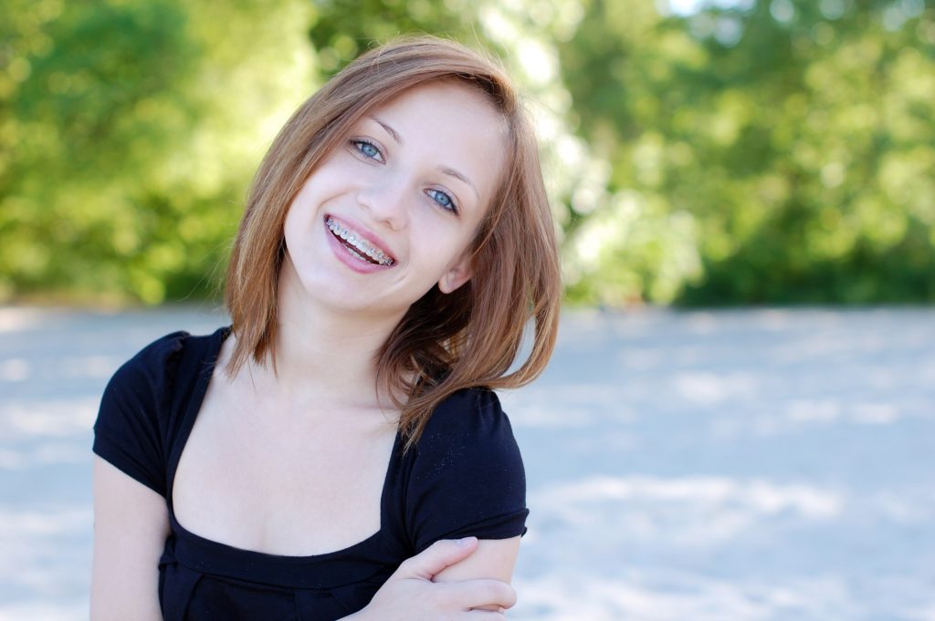 Charming girl wearing braces with a beautiful candid smile