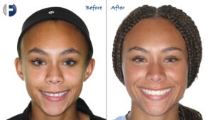 before and after image