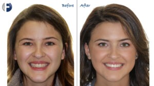 before and after image