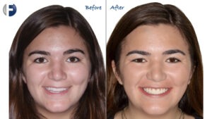before and after image