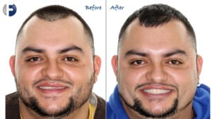 before and after image