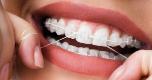 flossing with braces