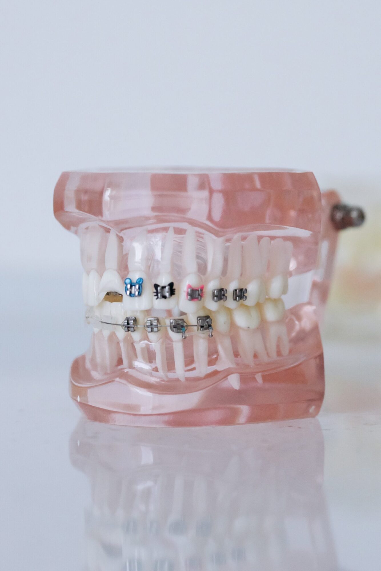 braces color