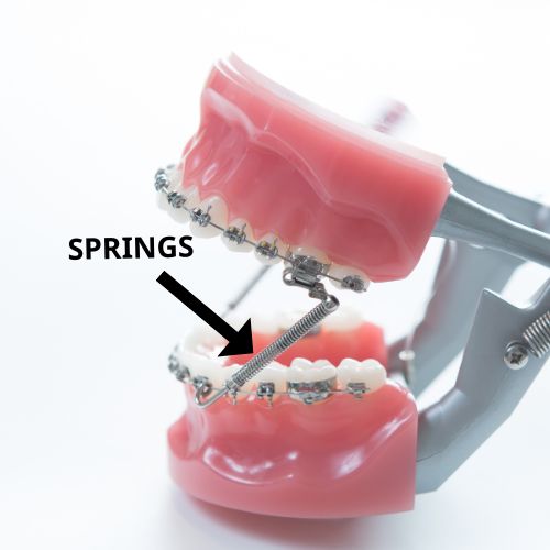 Orthodontic Molar Bands: The Ultimate Guide For 2023