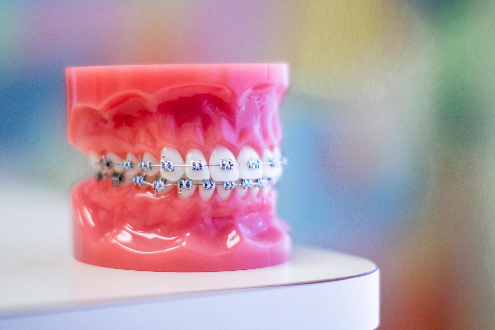 invisalign naperville il