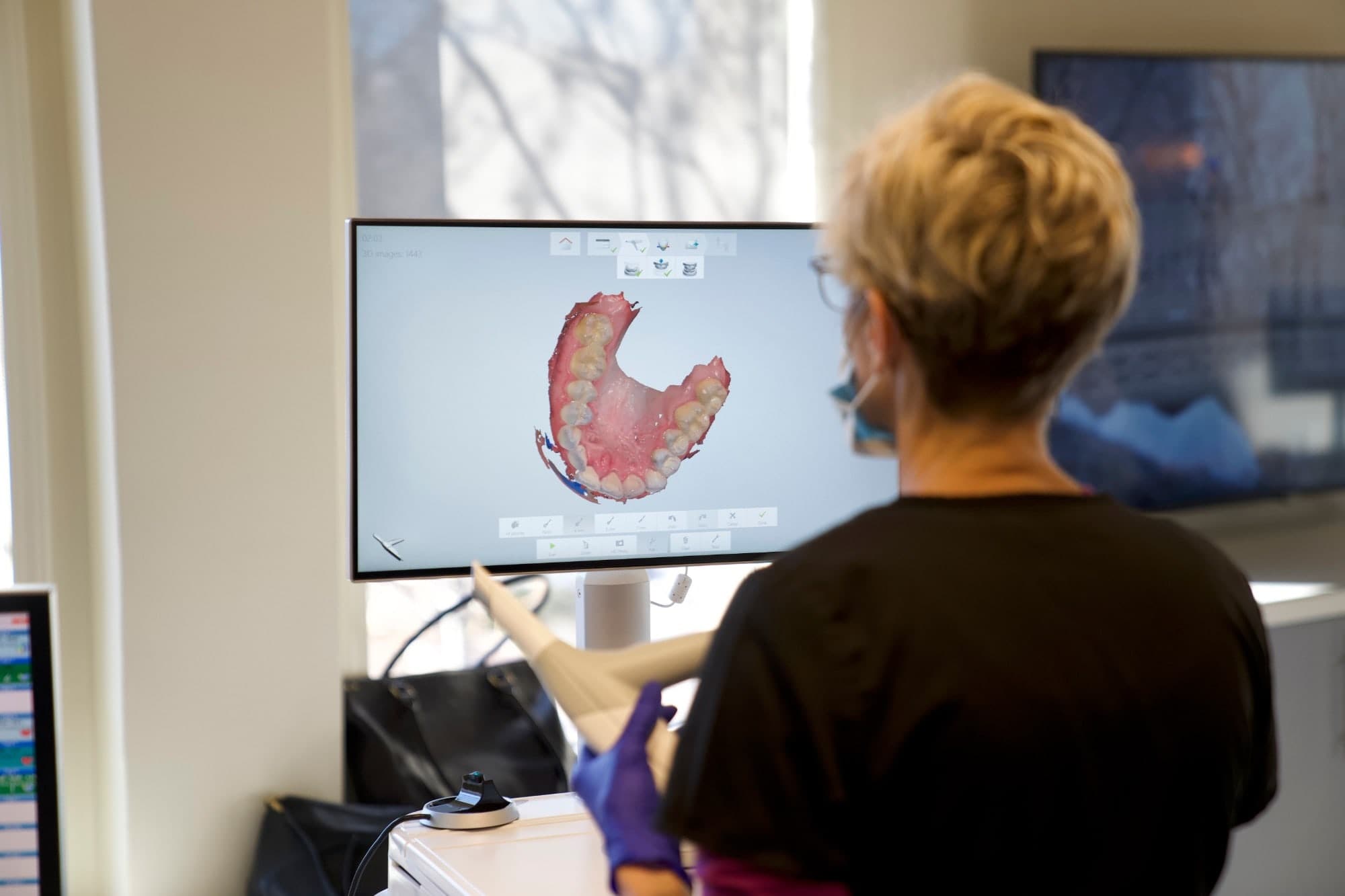 invisalign algonquin il