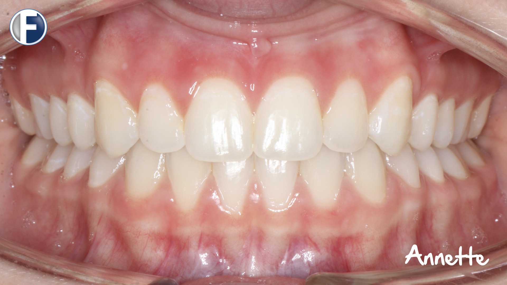 Frey - Master Collection copy 13.001