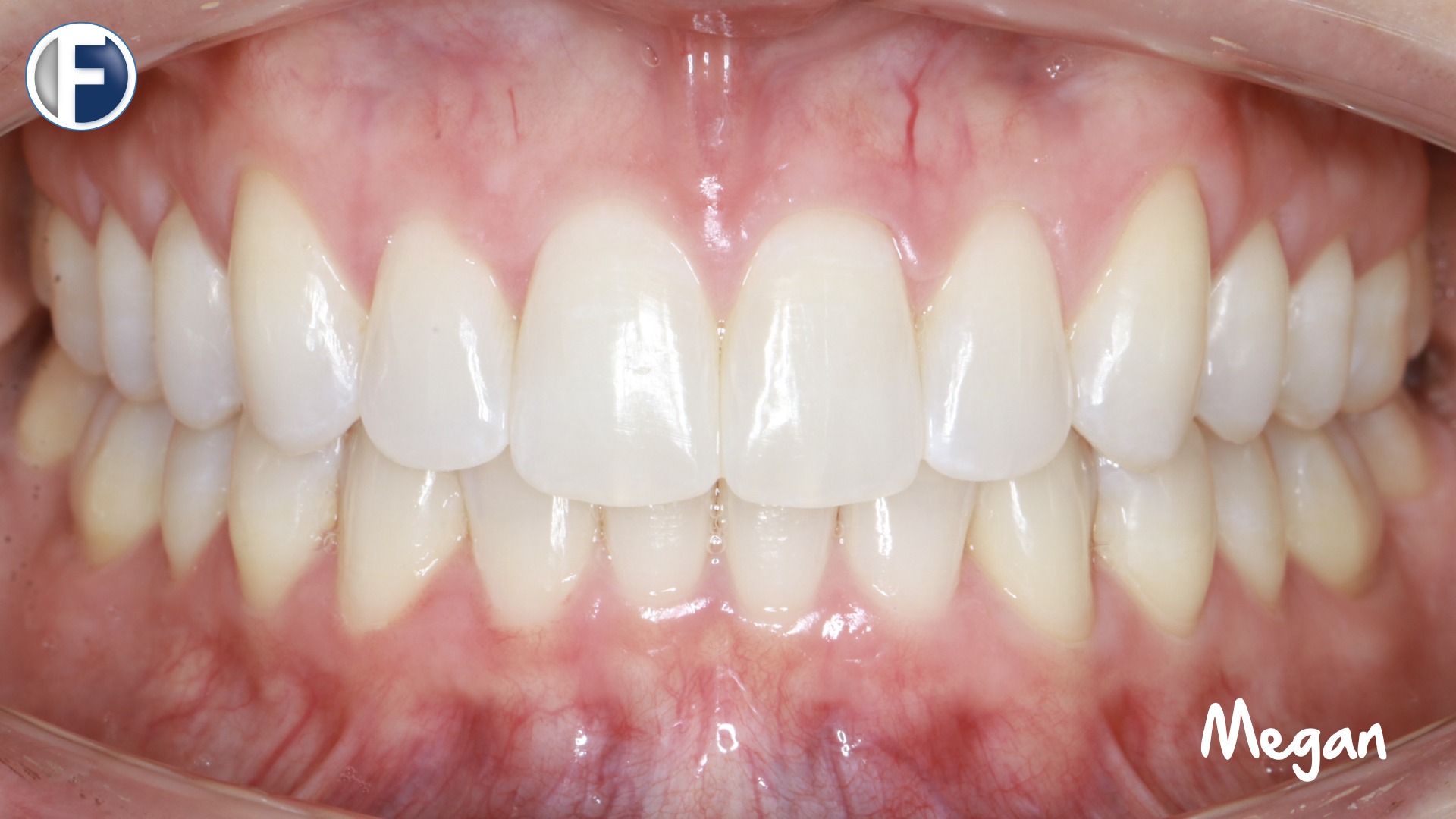 Frey - Master Collection copy 15.001