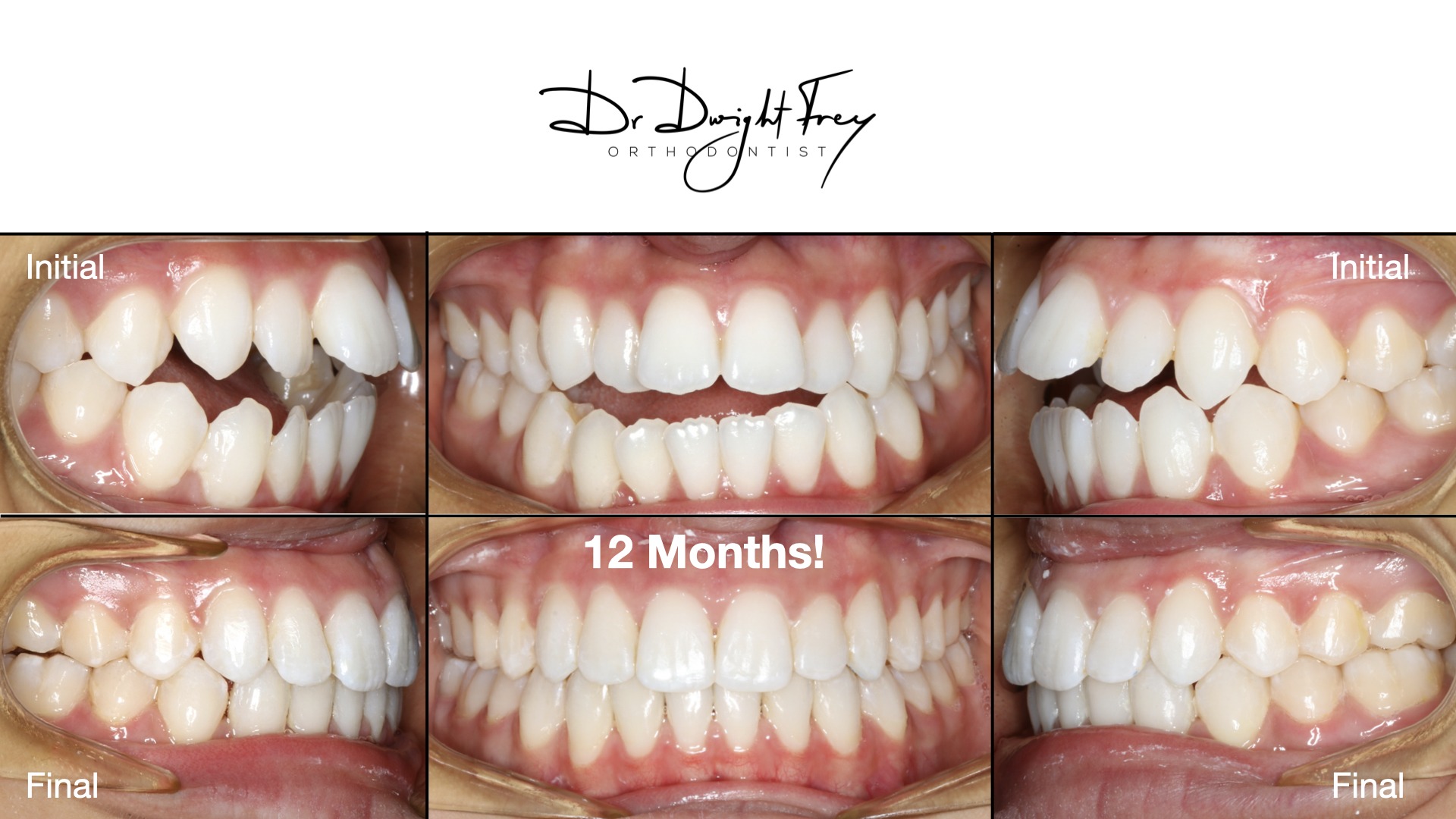 Frey - Master Collection.0017