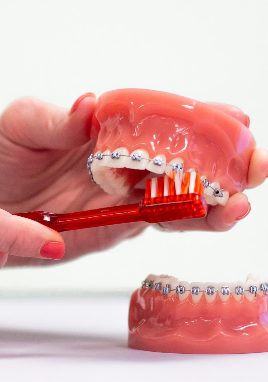 IMG_5924 frey orthodontics naperville