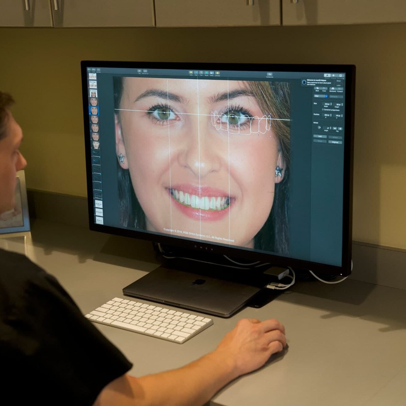 section-two invisalign algonquin il